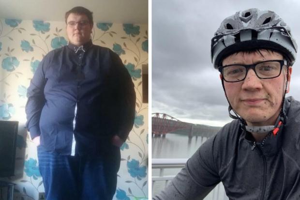 Before and after: Calum Paterson has lost 17 stone in six years.